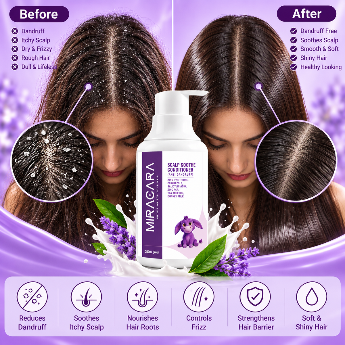 Miracara Scalp Soothe Anti-Dandruff Conditioner with Zinc Pyrithione, Climbazole, Salicylic Acid, Zinc PCA, Tea Tree Oil & Donkey Milk | Flake Care, Scalp Comfort, Oil Balance & Soft Hair